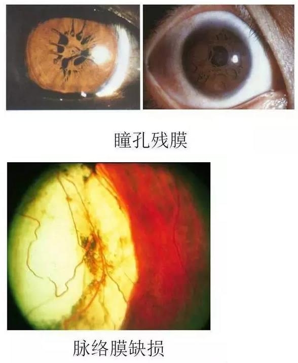 葡萄膜疾病与视网膜疾病病例图谱