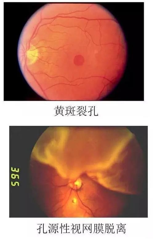 葡萄膜疾病与视网膜疾病病例图谱