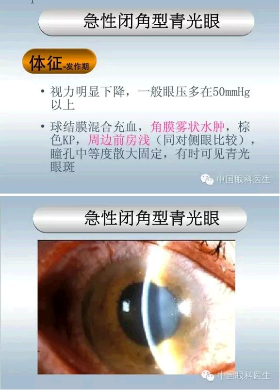 眼科急诊常见病处理方法和原则(ppt版)--打印文